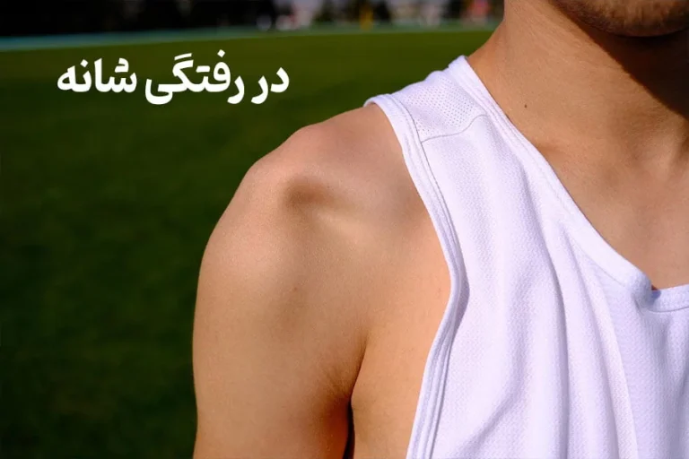 جراحی شانه در رفته