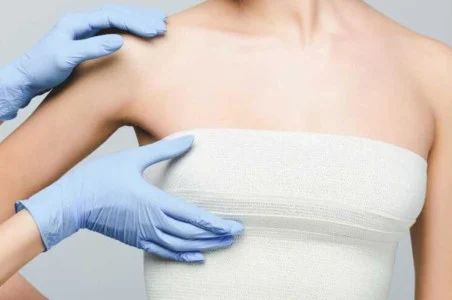 Complications after mammoplasty