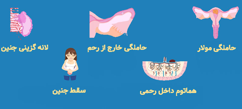 بارداری