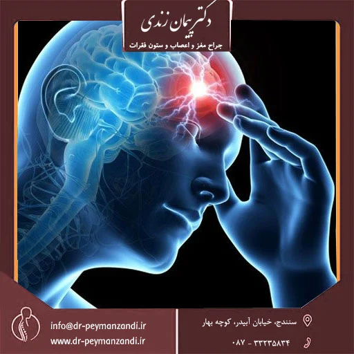 سردرد