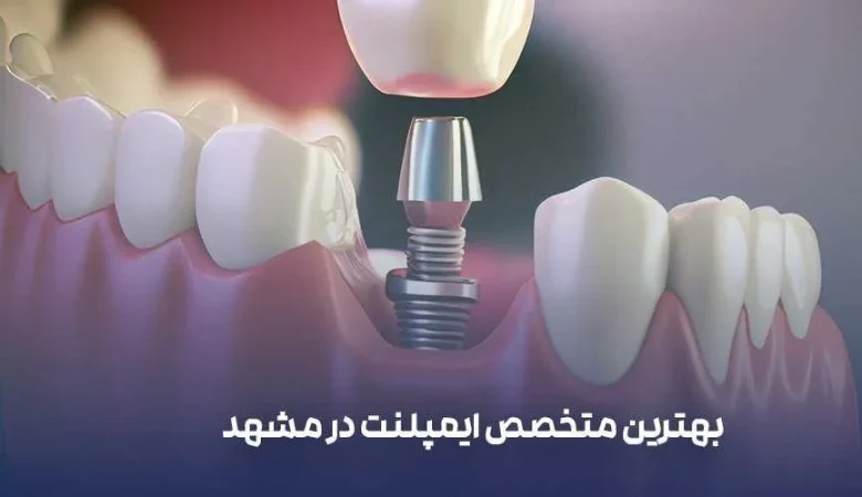 مشهد