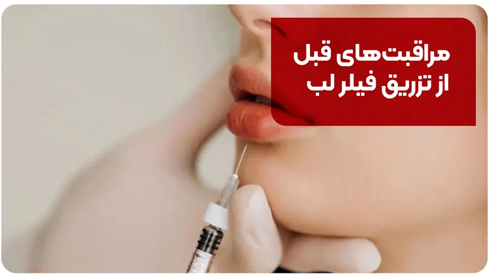 مراقبت&zwnj;های قبل از تزریق فیلر لب