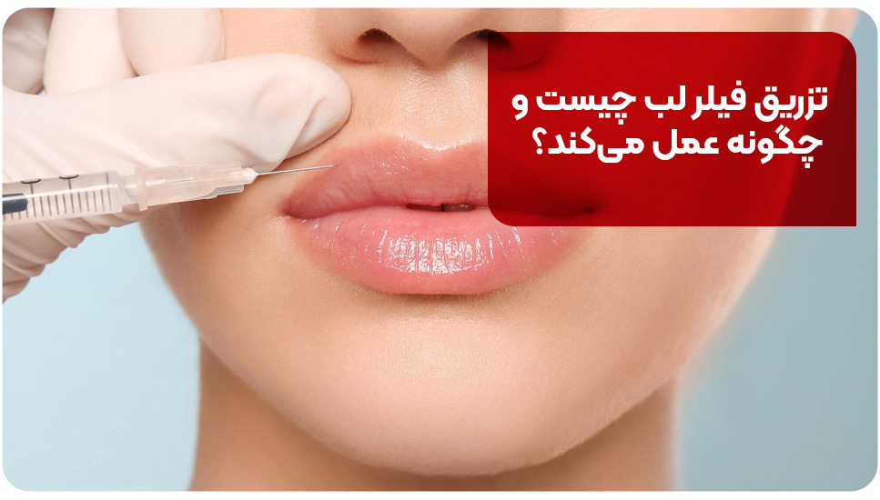 تزریق فیلر لب چیست و چگونه عمل می‌کند؟