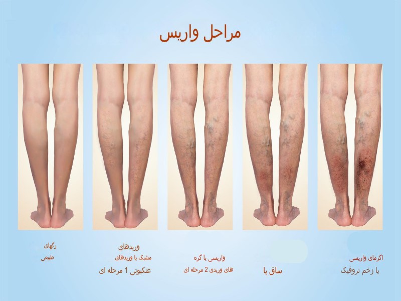 آشنایی | بیماری