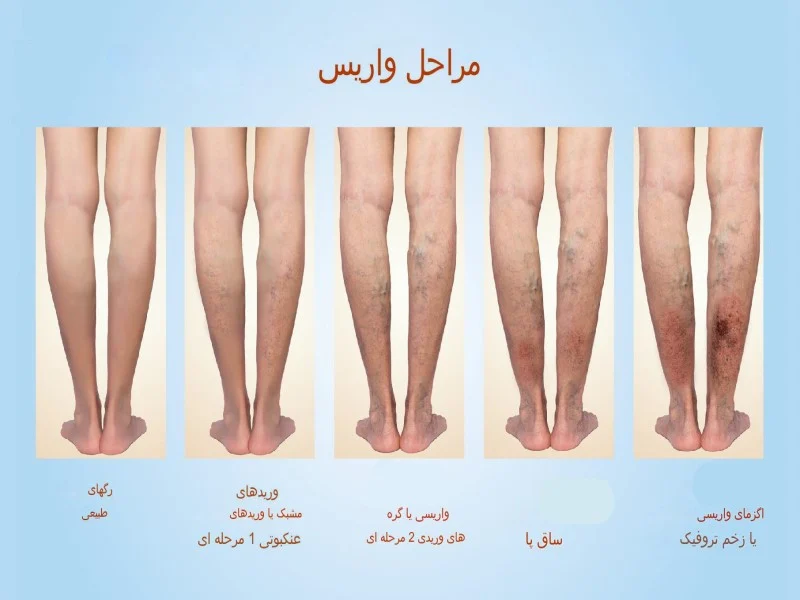 بیماری
