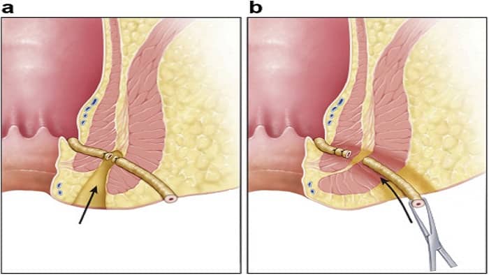 جراحی جراحی